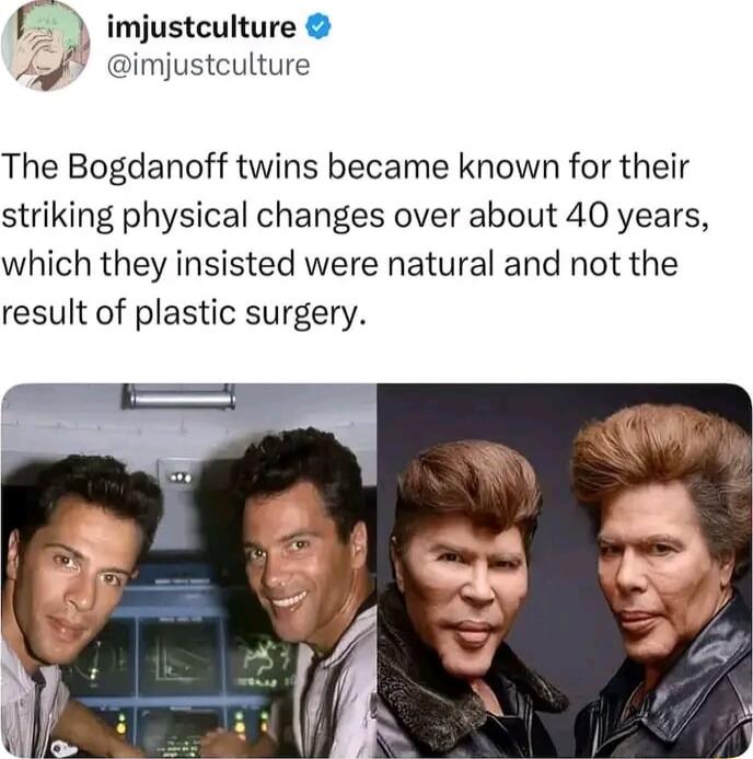 imjustculture @imjustculture The Bogdanoff twins became known for their striking physical changes over about 40 years, which they insisted were natural and not the result of plastic surgery.