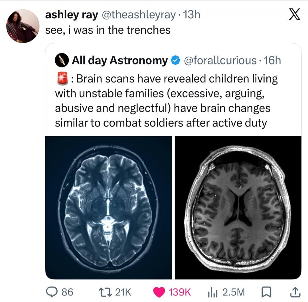 ashley ray @theashleyray 13h see, i was in the trenches. All day Astronomy @forallcurious 16h: Brain scans have revealed children living with unstable families (excessive, arguing, abusive and neglectful) have brain changes similar to combat soldiers after active duty