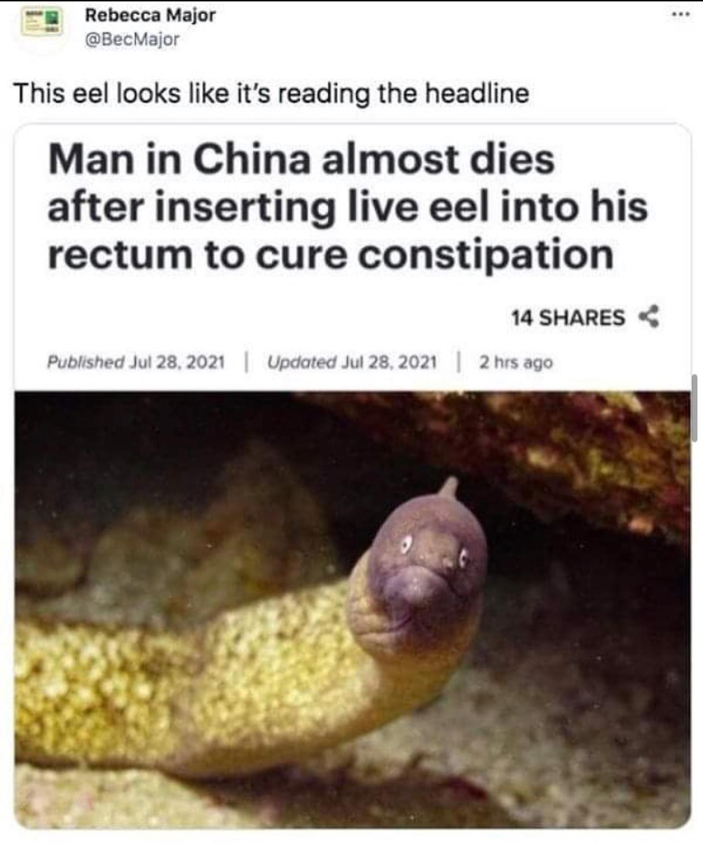 Rebecca Major BecMajor This eel looks like its reading the headline Man in China almost dies after inserting live eel into his rectum to cure constipation 14 SHARES Published Jul 28 2021 Updated Jul 28 2021 2 hrs ago