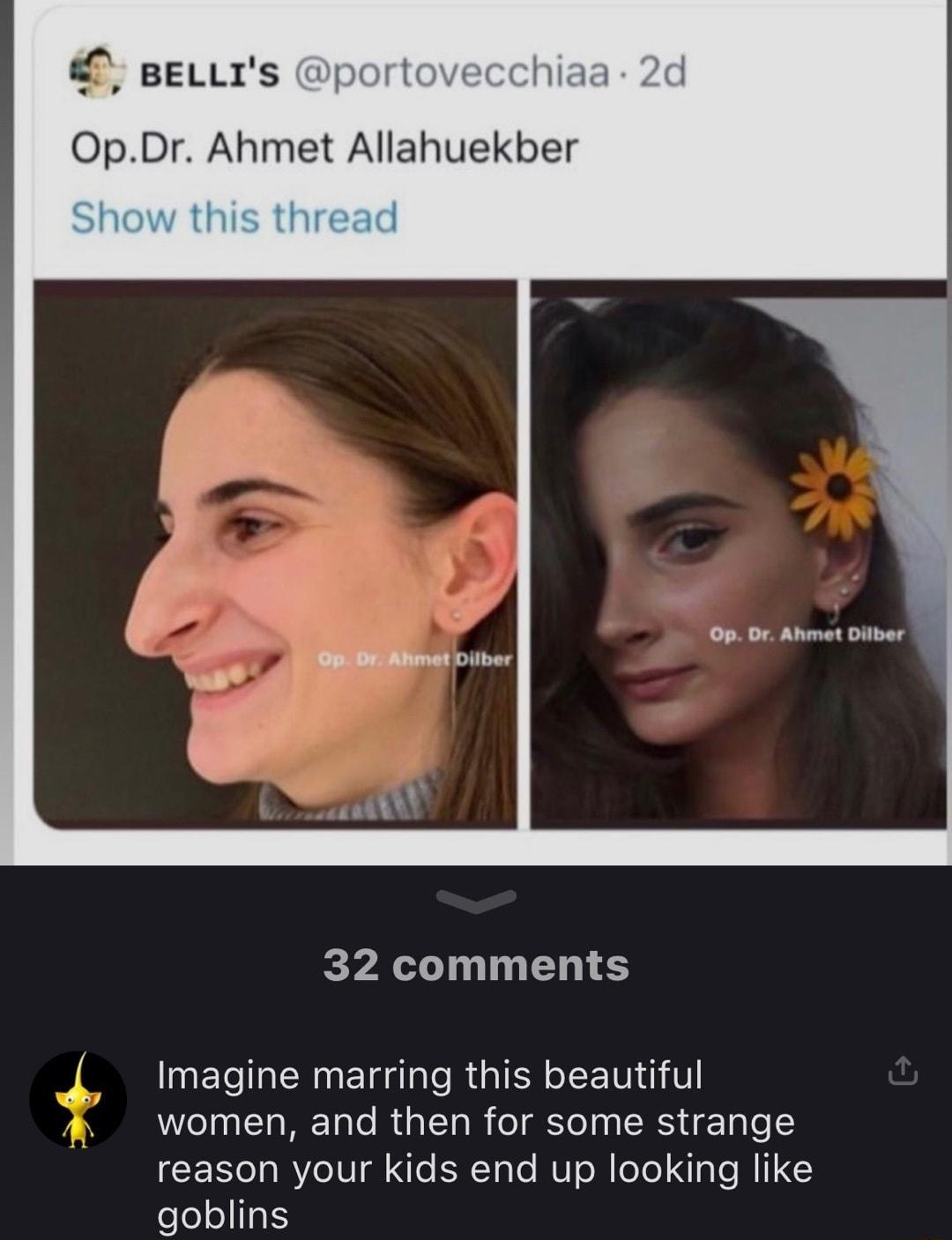 BELLIS portovecchia OpDr Ahmet Allahuekber 5 0 At iber 32 comments Imagine marring this beautiful women and then for some strange reason your kids end up looking like goblins