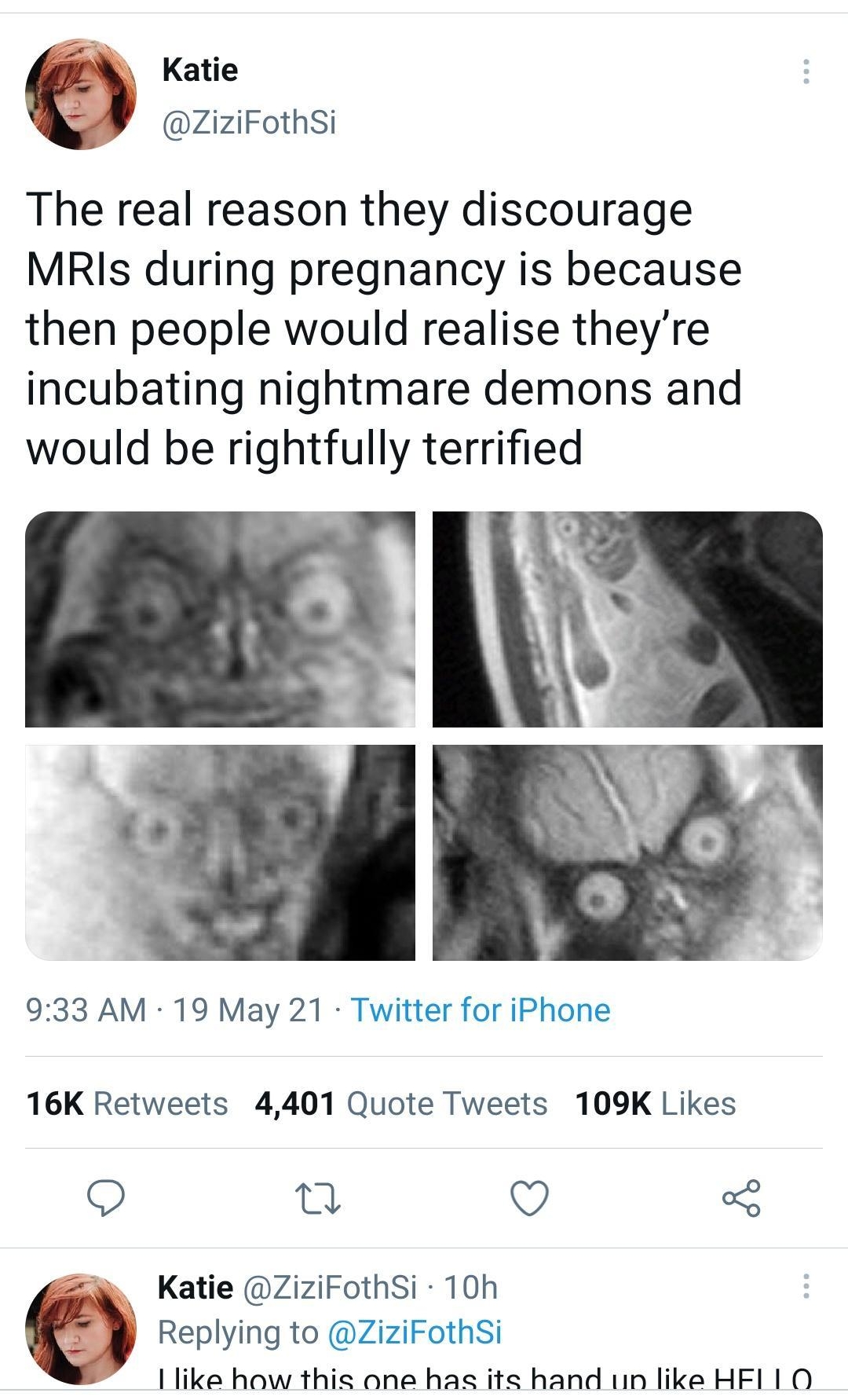 N Katie ZiziFothSi The real reason they discourage MRIs during pregnancy is because then people would realise theyre incubating nightmare demons and would be rightfully terrified 933 AM 19 May 21 Twitter for iPhone 16K Retweets 4401 Quote Tweets 109K Likes 0 v o8 Katie ZiziFothSi 10h 9 Replying to ZiziFothSi like how this one has its hand 1in like HFI 1 O