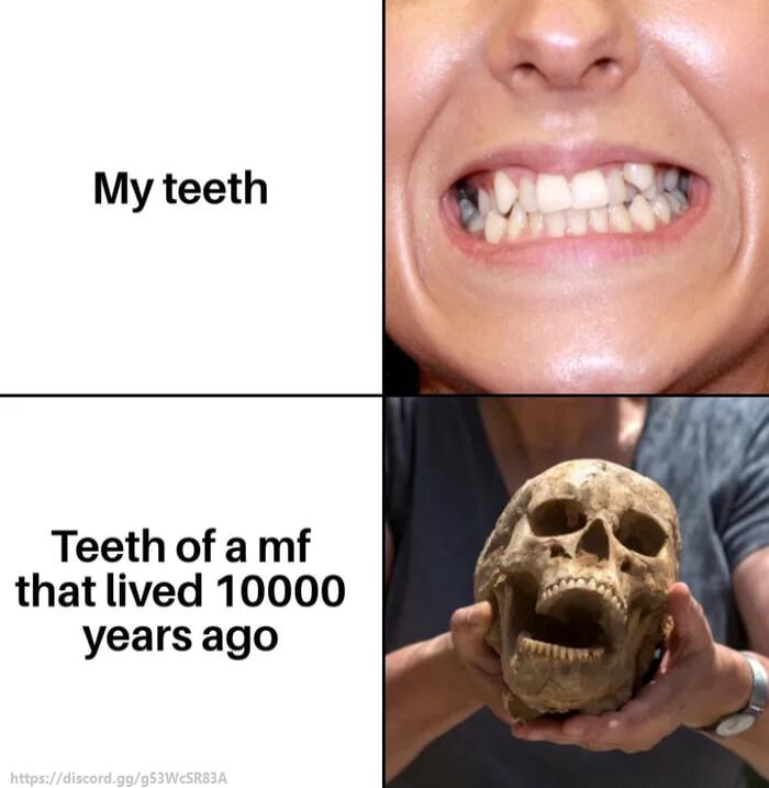 My teeth g Teeth of a mf that lived 10000 years ago