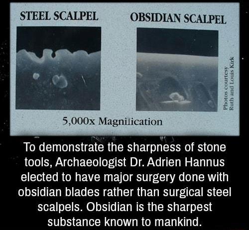 STEEL SCALPEL OBSIDIAN SCALPEL 5000x Magnilication R I A CRUER BT RN S o 1 tools Archaeologist Dr Adrien Hannus TR G RN PR g 1o SV Lo A o1 ERUT obsidian blades rather than surgical steel scalpels Obsidian is the sharpest substance known to mankind