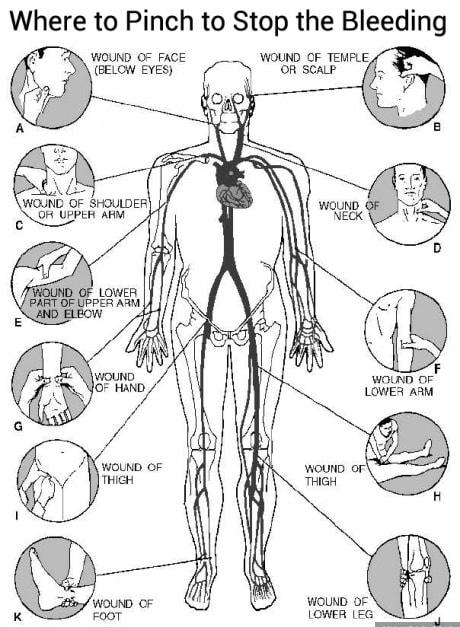 Where to Pinch to Stop the Bleeding WOUND OF FACE WOUND OF TEMPLE 4 3 BELOW YES o scaLp T o e b A 4 B g i WaURD OF routoes O UEPER AHM T WouND WOUND OF LOWER EG S