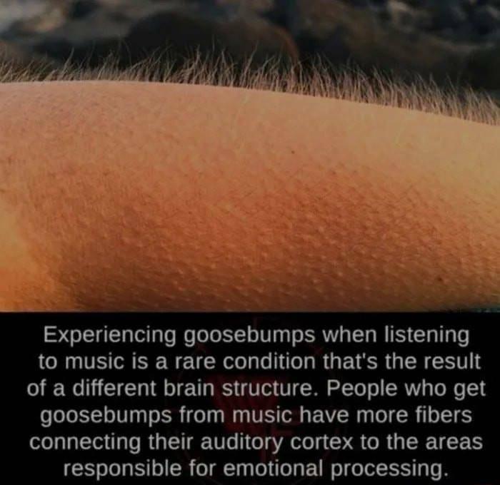 Experiencing goosebumps when listening CRUITE RN EICR I RUETER GRS of a different brain structure People who get goosebumps from music have more fibers connecting their auditory cortex to the areas responsible for emotional processing