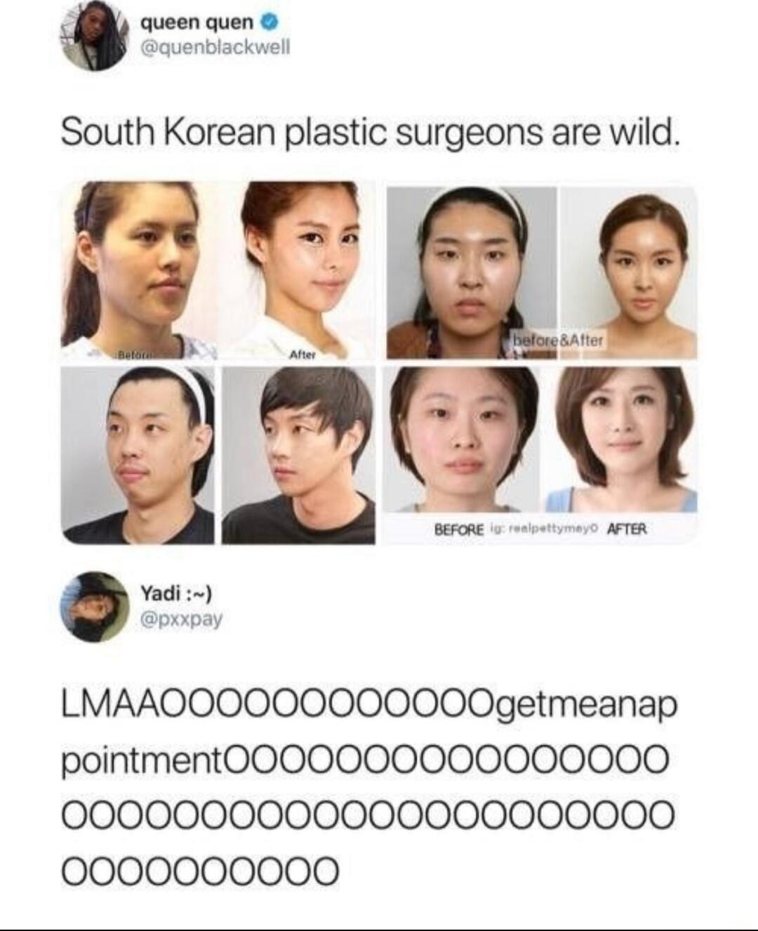 queen quen South Korean plastic surgeons are wild e TR LMAAOOOOOOO00000getmeanap pointmentO0O00000000000000 0000000000000000000000 0000000000