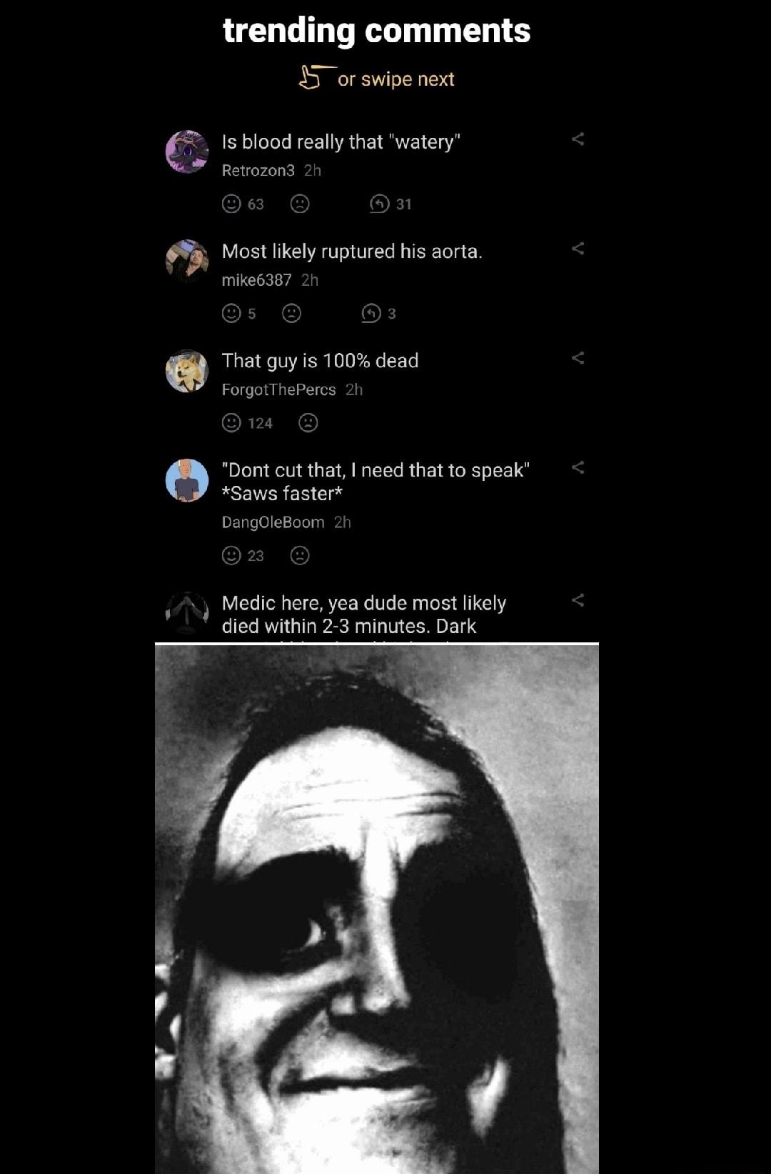 trending comments 55 or swipe next Is blood really that watery Most likely ruptured his aorta That guy is 100 dead Dont cut that need that to speak Saws faster o 2 Medic here yea dude most likely died within 23 minutes Dark
