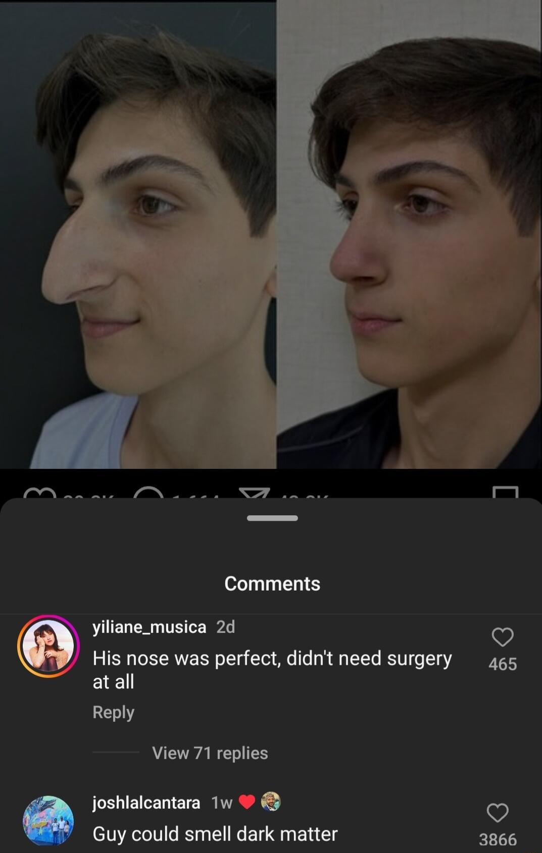 Comments yiliane_musica 2d His nose was perfect didnt need surgery atall View 71 replies joshlalcantara 1w Guy could smell dark matter v 465 3866