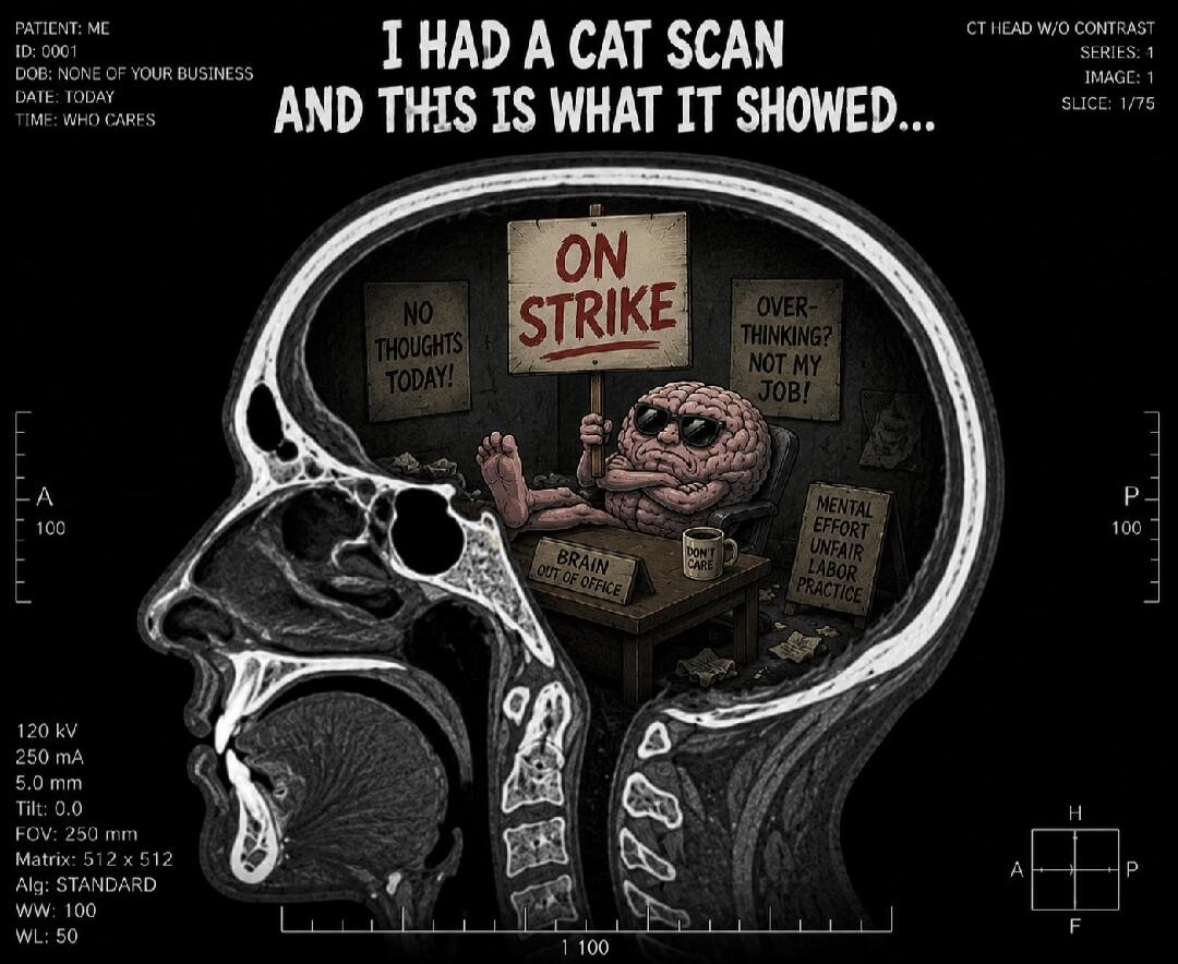 PATIENT: ME ID: 0001 DOB: NONE OF YOUR BUSINESS DATE: TODAY TIME: WHO CARES CT HEAD W/O CONTRAST SERIES: 1 IMAGE: 1 SLICE: 1/75 I HAD A CAT SCAN AND THIS IS WHAT IT SHOWED... ON STRIKE NO THOUGHTS TODAY! OVER-THINKING? NOT MY JOB! BRAIN OUT OF OFFICE MENTAL EFFORT UNFAIR LABOR PRACTICE DON'T CARE 120 kV 250 mA 5.0 mm Tilt: 0.0 FOV: 250 mm Matrix: 5