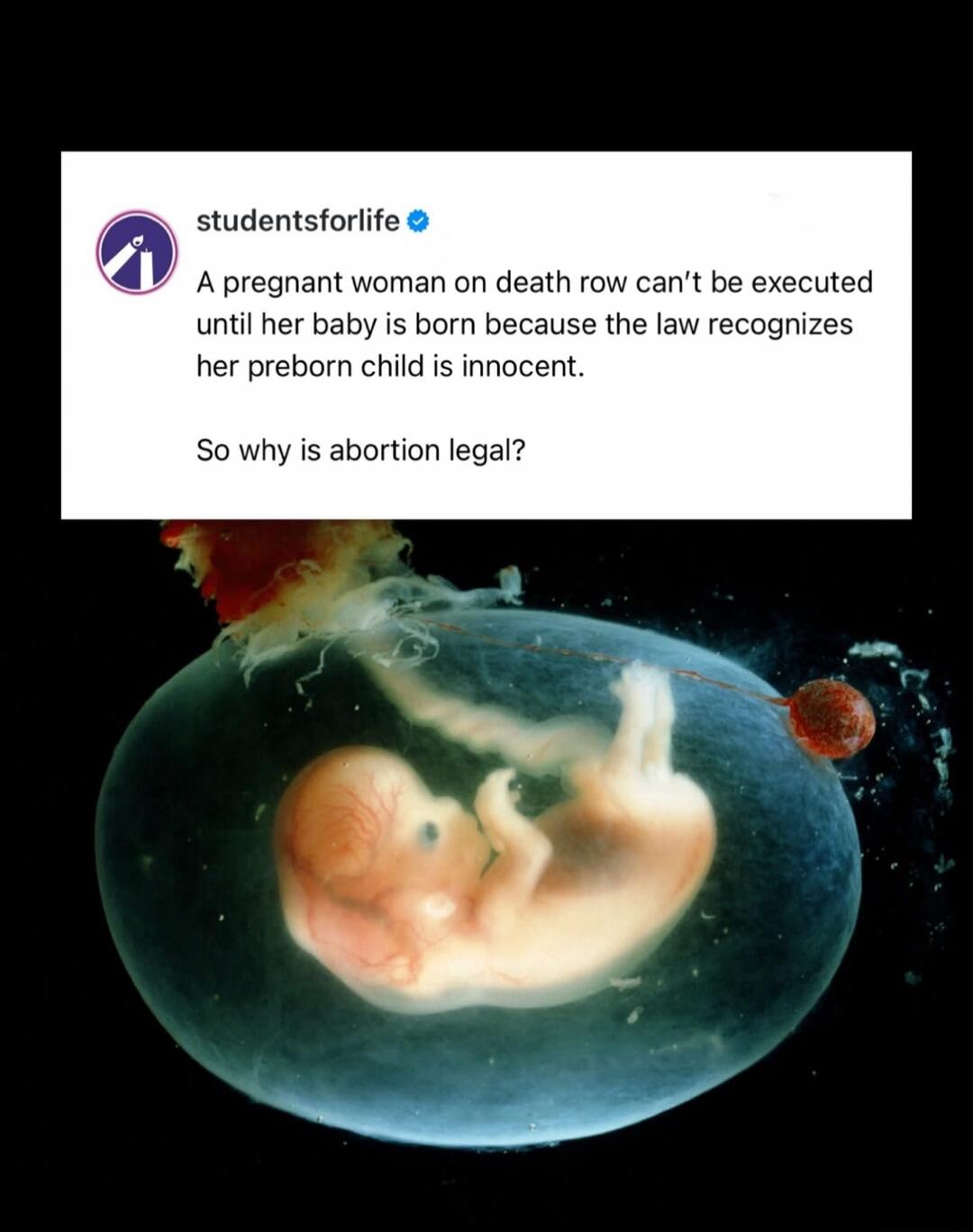 studentsforlife A pregnant woman on death row can't be executed until her baby is born because the law recognizes her preborn child is innocent. So why is abortion legal?