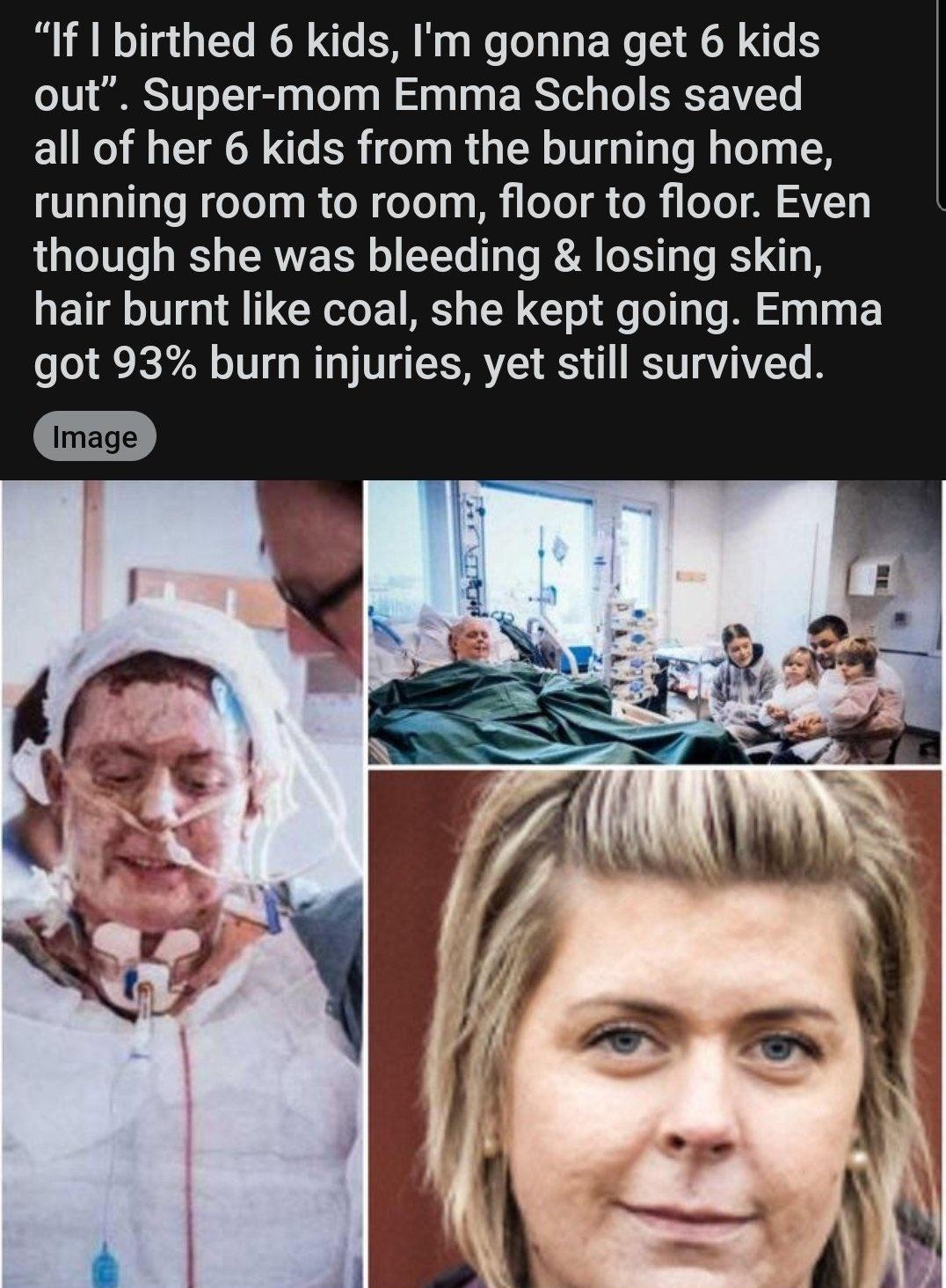 LI ETS I S o 2001S To W o ATVASTIetel 1S3 U M ToTo V el RO L N W To o W1 4 81213 202 821 227 1 L oY g CTe SN e B W g W Lo T a Lo E We W AT 5 out Super mom Emma Schols saved all of her 6 kids from the burning home running room to room floor to floor Even though she was bleeding losing skin hair burnt like coal she kept going Emma got 93 burn injuries yet still survived