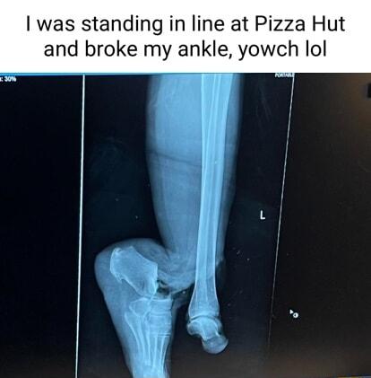 was standing in line at Pizza H and broke my ankle yowch lol i B