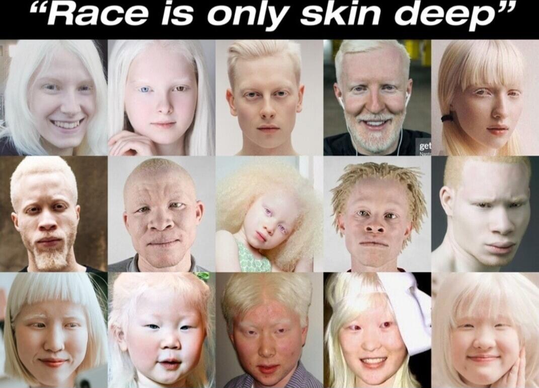 Race is only skin deep