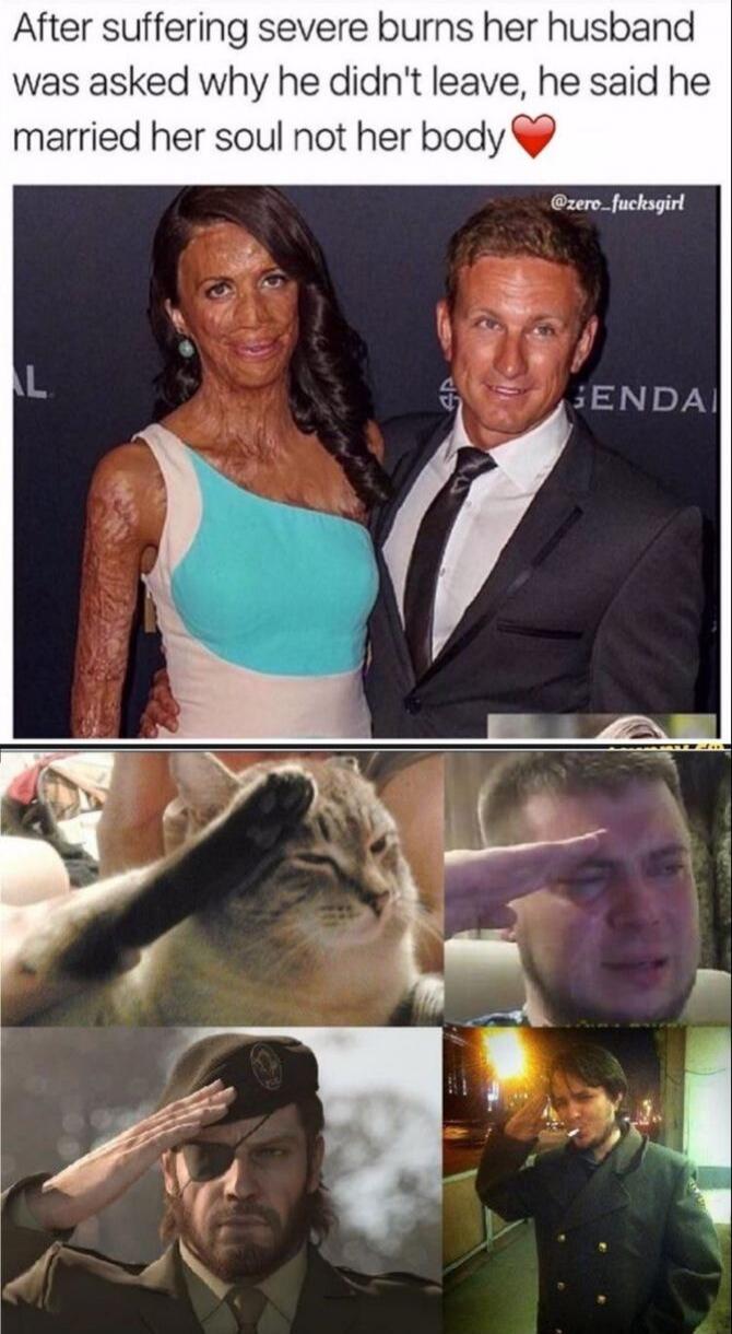 After suffering severe burns her husband was asked why he didn't leave, he said he married her soul not her body❤️