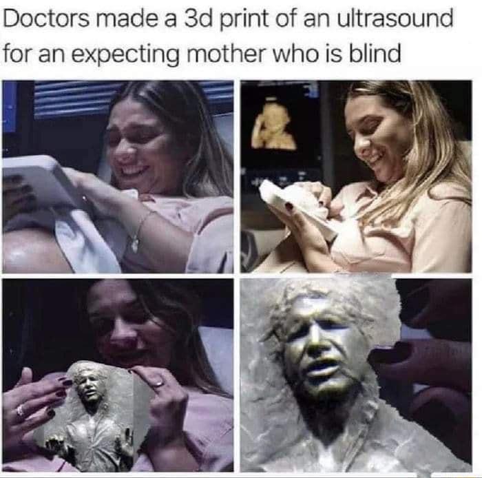 Doctors made a 3d print of an ultrasound for an expecting mother who is blind