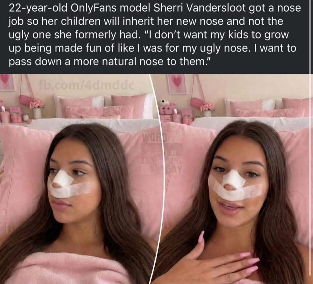 22-year-old OnlyFans model Sherri Vandersloot got a nose job so her children will inherit her new nose and not the ugly one she formerly had. “I don’t want my kids to grow up being made fun of like I was for my ugly nose. I want to pass down a more natural nose to them.”