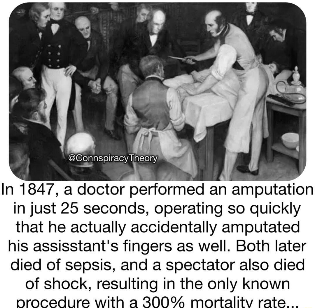 In 1847 a doctor performed an amputation in just 25 seconds operating so quickly that he actually accidentally amputated his assisstants fingers as well Both later died of sepsis and a spectator also died of shock resulting in the only known nrocedure with a 300 mortalitv rate
