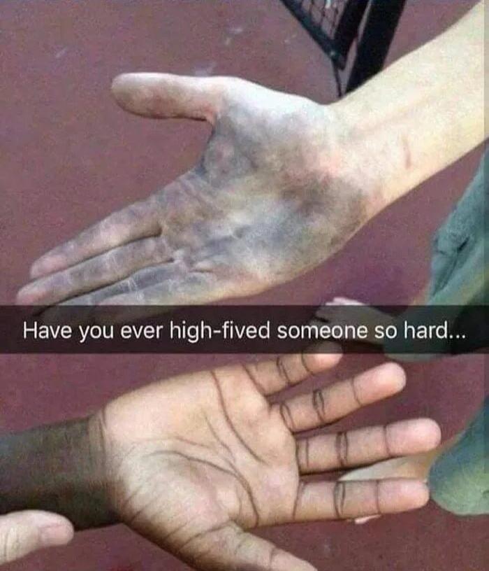 Have you ever high fived someone so hard o