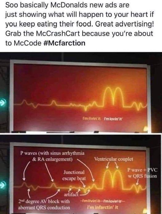 Soo basically McDonalds new ads are just showing what will happen to your heart if you keep eating their food Great advertising Grab the McCrashCart because youre about to McCode Mcfarction Fmlovir it P waves with sinus arrhythmia RA cnlargement _ Veatriculag couplet cociont R Be i 7 e W block with aberrant QRS conduction