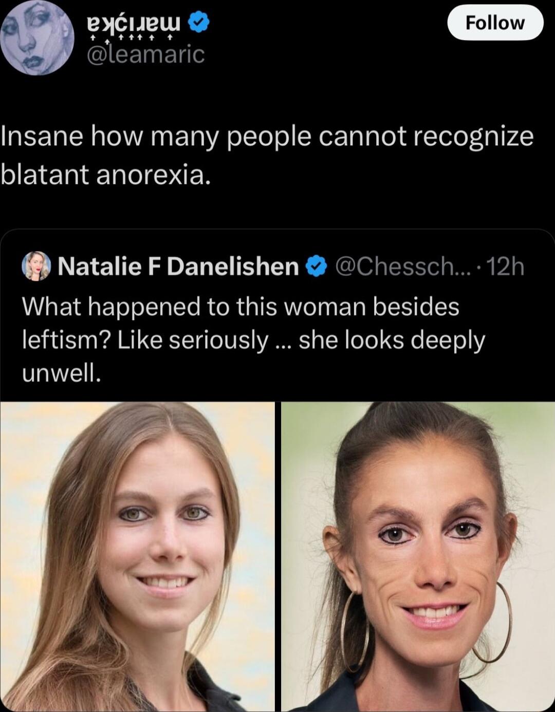 Follow EET N IR ETa VA oToToTo SN Ta T Tol gTele 3 1745 SJETETIEETTeIEN Natalie F Danelishen Chessch 12h What happened to this woman besides leftism Like seriously she looks deeply unwell