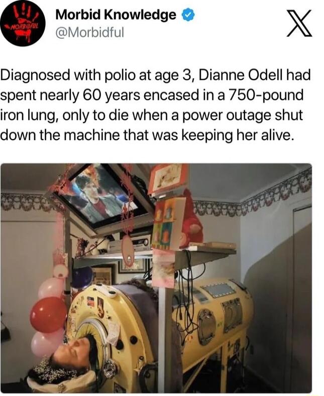 Morbid Knowledge rbidful Diagnosed with polio at age 3 Dianne Odell had spent nearly 60 years encased in a 750 pound iron lung only to die when a power outage shut down the machine that was keeping her alive
