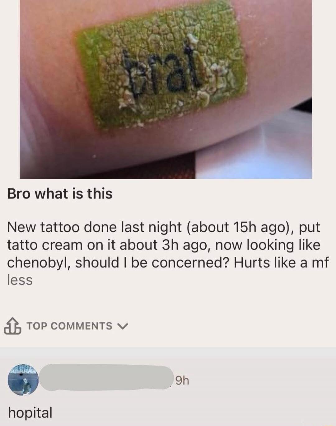 Bro what is this

New tattoo done last night (about 15h ago), put tattoo cream on it about 3h ago, now looking like chenobyl, should I be concerned? Hurts like a mf less

hospital