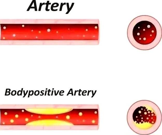 Artery Bodypositive Artery
