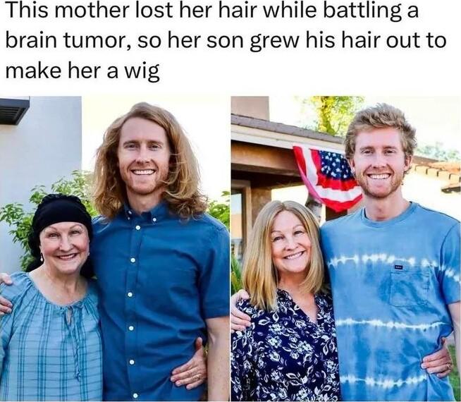 This mother lost her hair while battling a brain tumor so her son grew his hair out to make her a wig