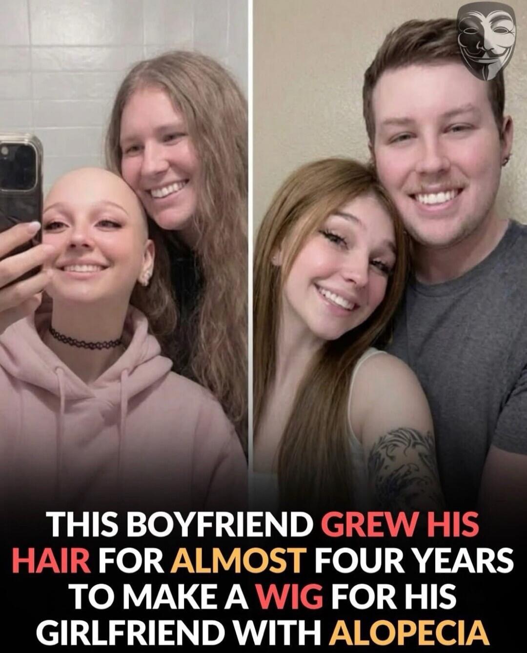 THIS BOYFRIEND GREW HIS HAIR FOR ALMOST FOUR YEARS TO MAKE A WIG FOR HIS GIRLFRIEND WITH ALOPECIA