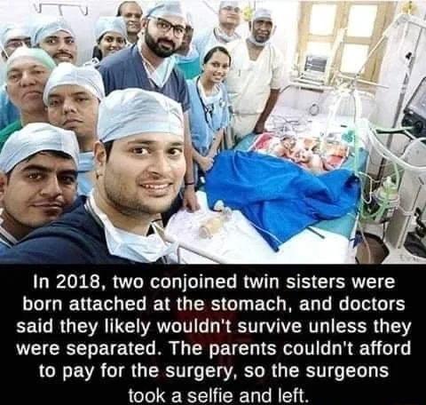 In 2018 two conjoined twin sisters were LLIGIENETR L TR GRS G ET R TGS said they likely wouldnt survive unless they were separated The parents couldnt afford LN EVR TR GRS LA R G R LI B took a selfie and left