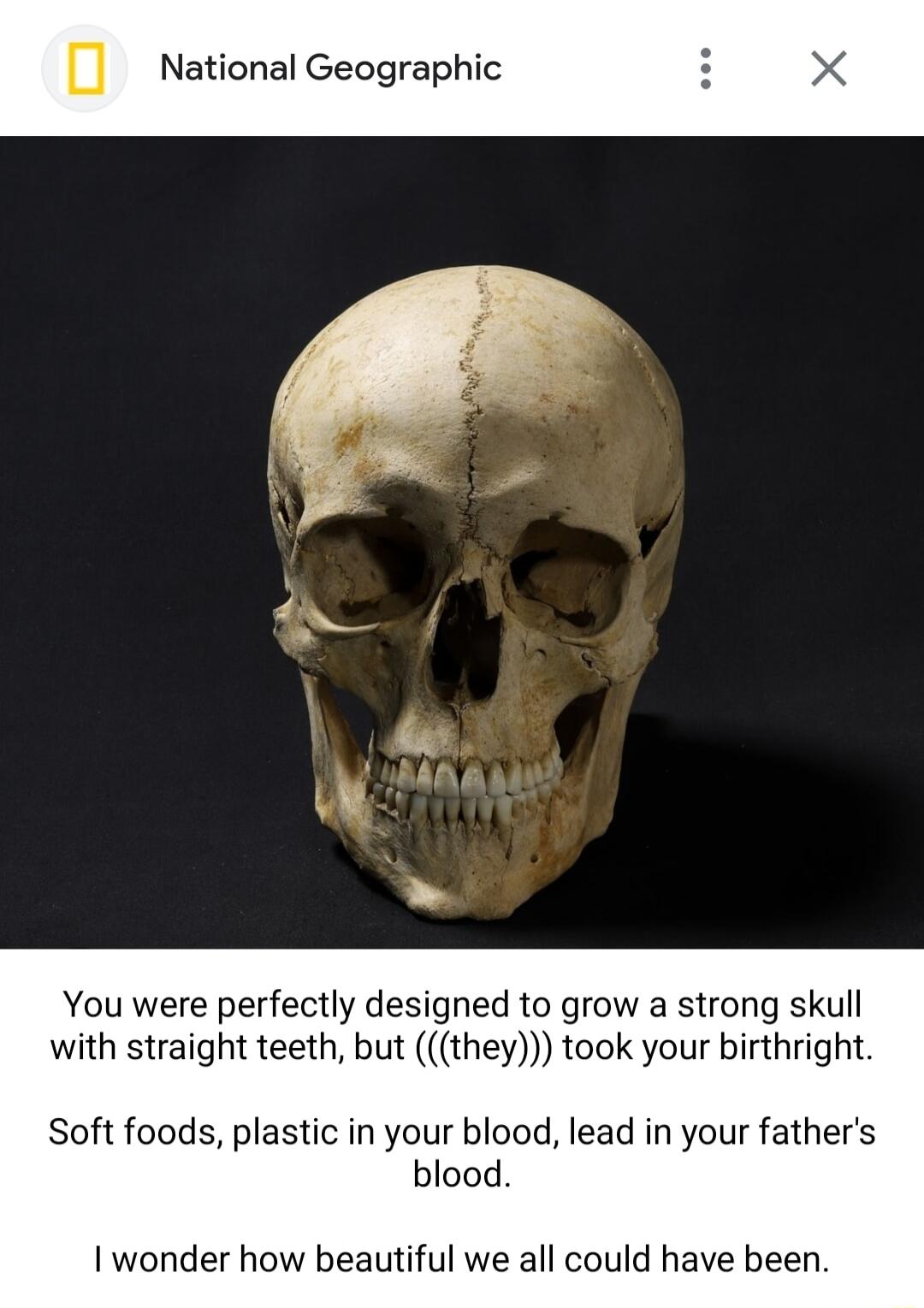 National Geographic You were perfectly designed to grow a strong skull with straight teeth but they took your birthright Soft foods plastic in your blood lead in your fathers blood I wonder how beautiful we all could have been