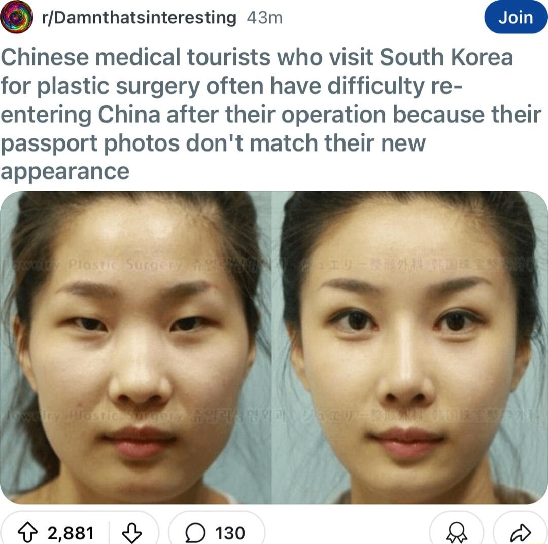 Q rDamnthatsinteresting 43m Chinese medical tourists who visit South Korea for plastic surgery often have difficulty re entering China after their operation because their passport photos dont match their new appearance