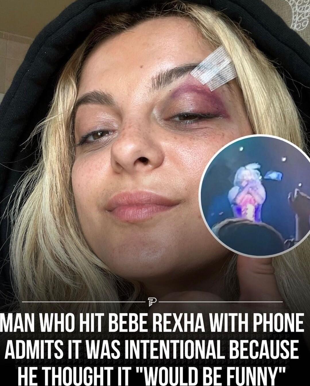 MAN WHO HIT BEBEFREXHA WITH PHONE ADMITS IT WAS INTENTIONAL BECAUSE HE THOUGHT IT WOULD BE FUNNY