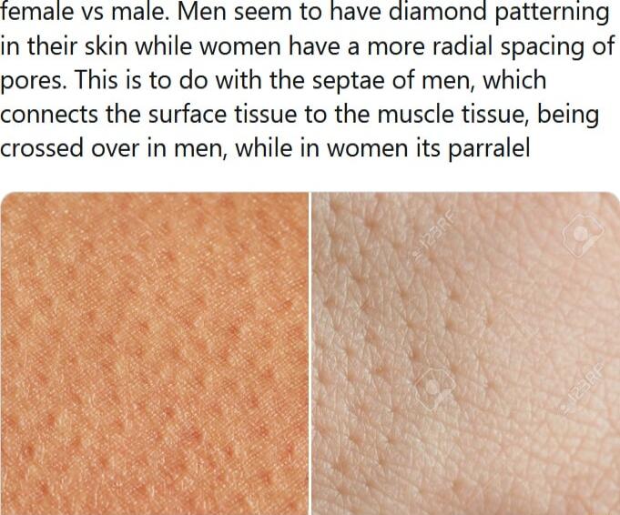 female vs male Men seem to have diamond patterning in their skin while women have a more radial spacing of pores This is to do with the septae of men which connects the surface tissue to the muscle tissue being crossed over in men while in women its parralel
