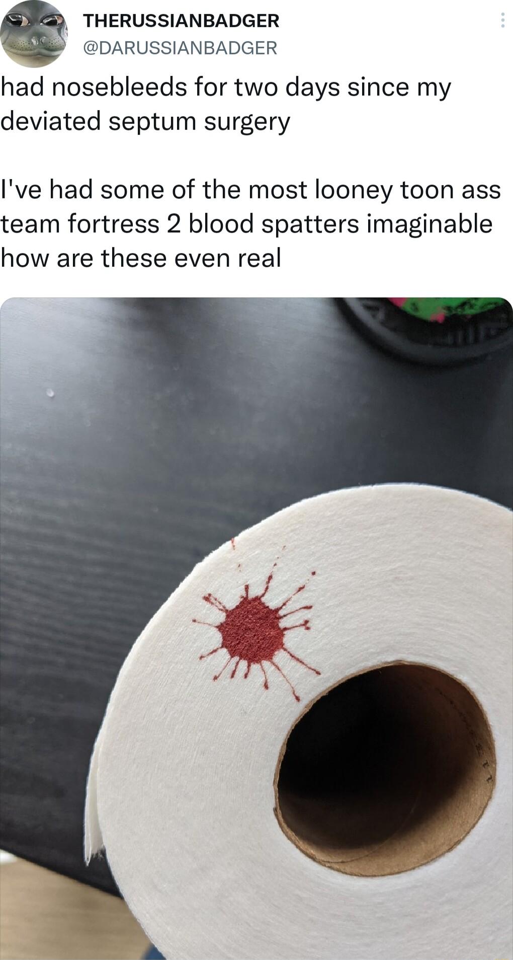 THERUSSIANBADGER DARUSSIANBADGER had nosebleeds for two days since my deviated septum surgery Ive had some of the most looney toon ass team fortress 2 blood spatters imaginable how are these even real