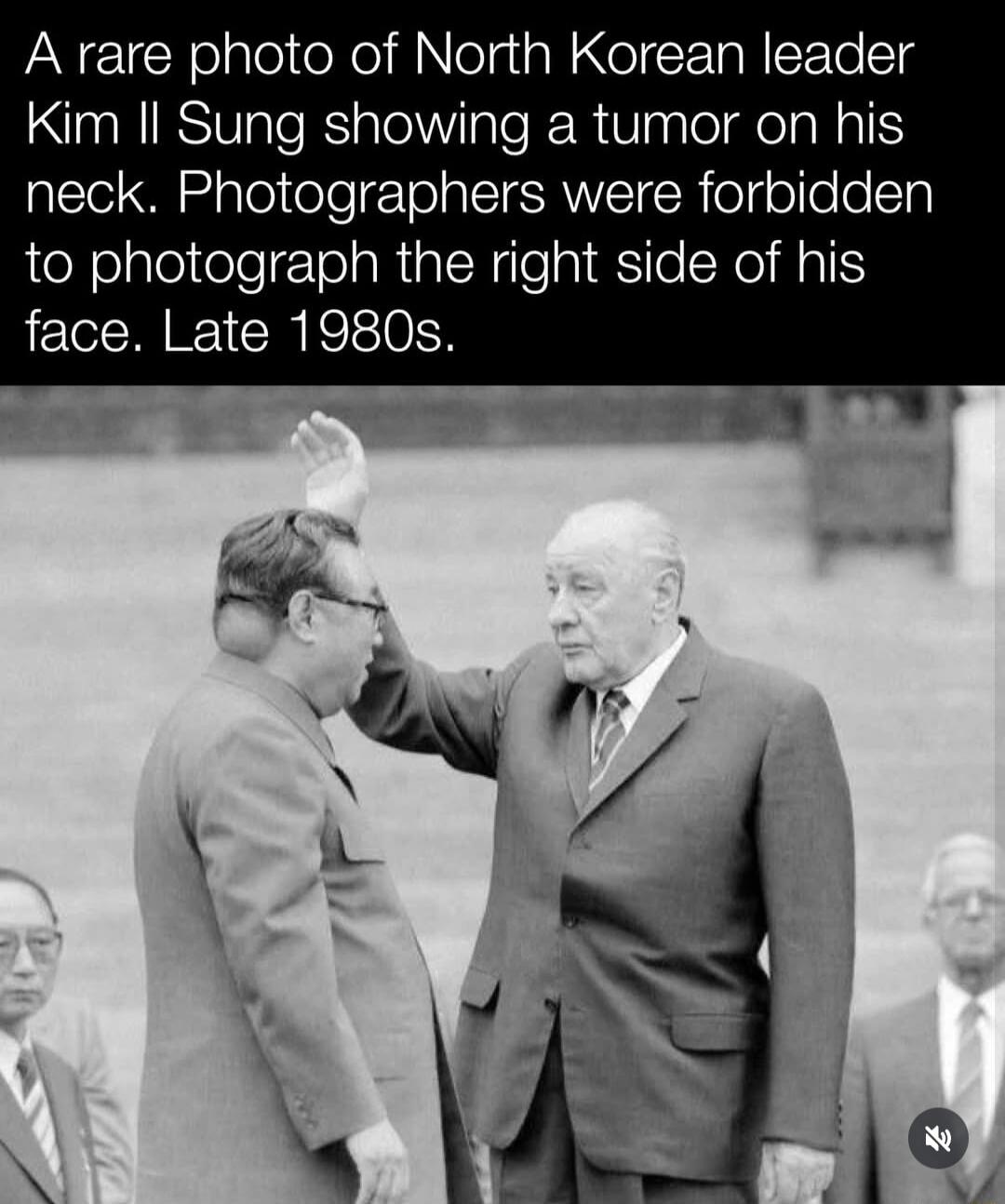 A rare photo of North Korean leader Kim Il Sung showing a tumor on his neck. Photographers were forbidden to photograph the right side of his face. Late 1980s.