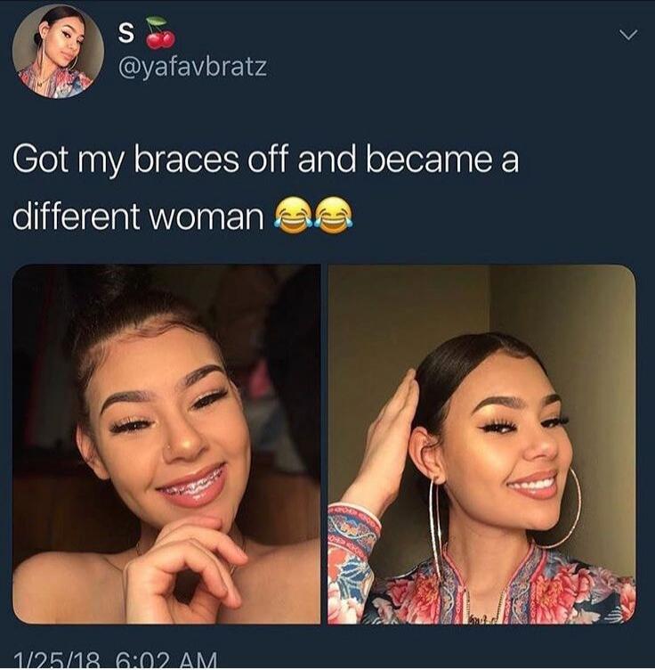 S @yafaybratz Got my braces off and became a different woman 😂😂😂 1/25/18 6:02 AM
