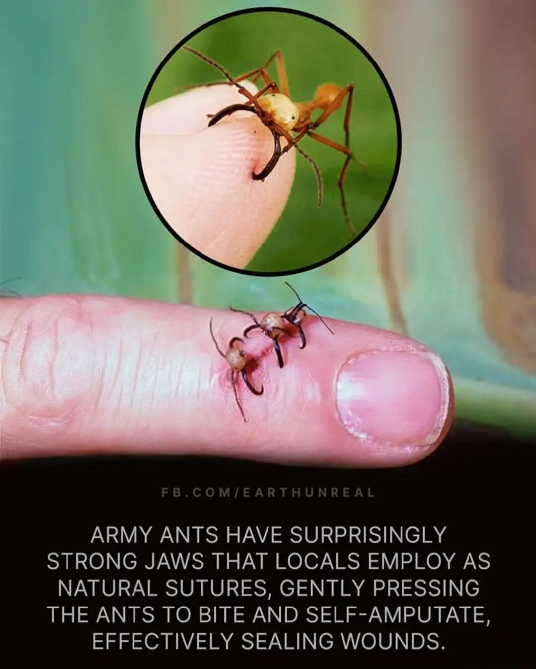 ARMY ANTS HAVE SURPRISINGLY STRONG JAWS THAT LOCALS EMPLOY AS NATURAL SUTURES GENTLY PRESSING THE ANTS TO BITE AND SELF AMPUTATE EFFECTIVELY SEALING WOUNDS
