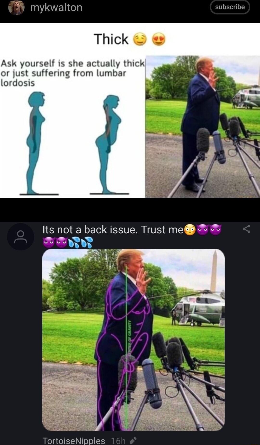 mykwalton Thick Ask yourself is she actually thick or just suffering from lumbar lordosis Its not a back issue Trust me o 114