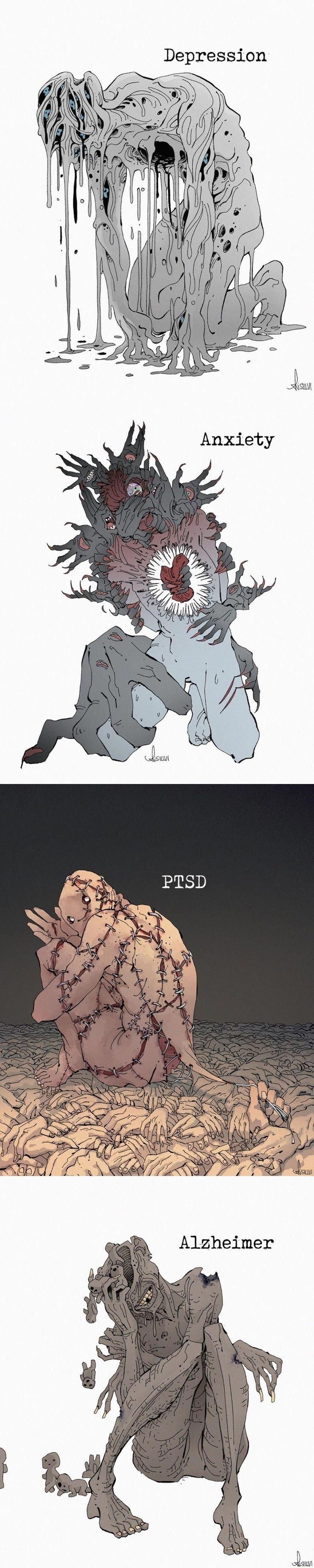 Depression Alzheimer QSLLA