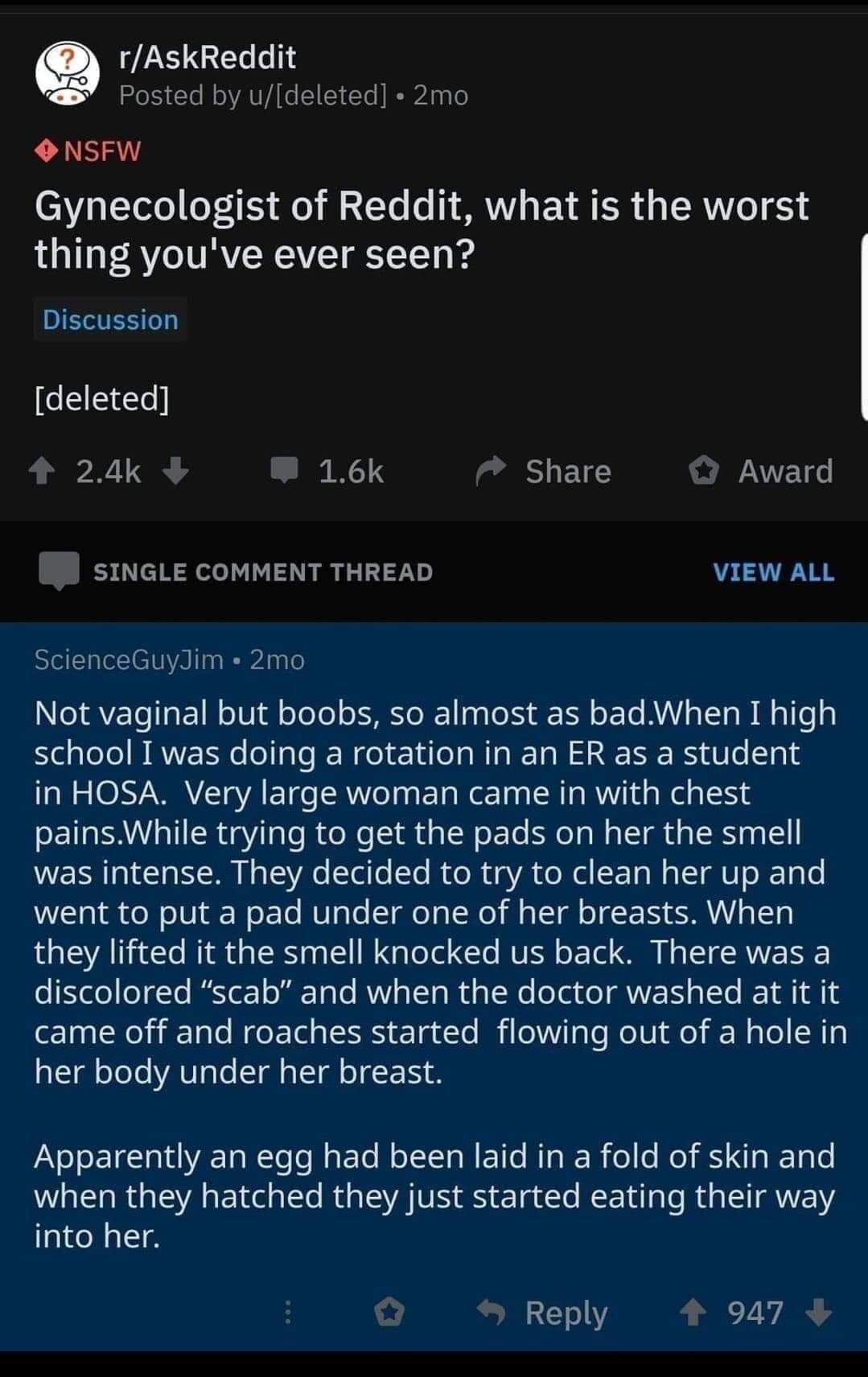 Q rAskReddit Posted by udeleted 2mo ONSFW Gynecologist of Reddit what is the worst thing youve ever seen Discussion CEEES 4 24k W 16k Share Award I SthGLE CoMMENT THREAD rem ScienceGuydim 2mo Not vaginal but boobs so almost as bad When I high H I B RNERN TR E RN N R in HOSA Very large woman came in with chest painsWhile trying to get the pads on her the smell was intense They decided to try to cle