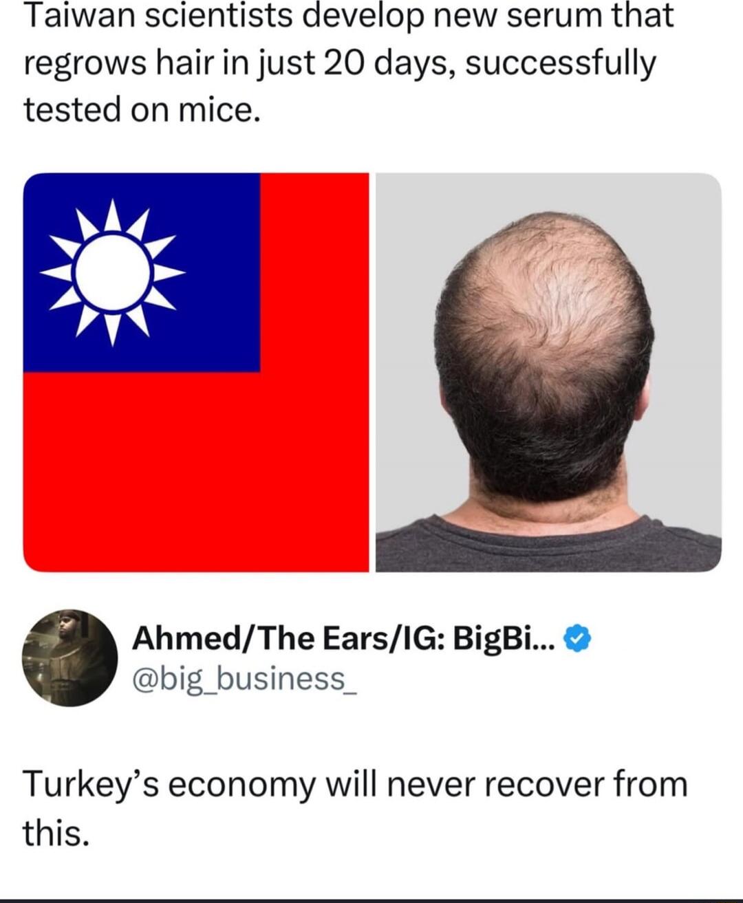 Taiwan scientists develop new serum that regrows hair in just 20 days, successfully tested on mice. Turkey’s economy will never recover from this.