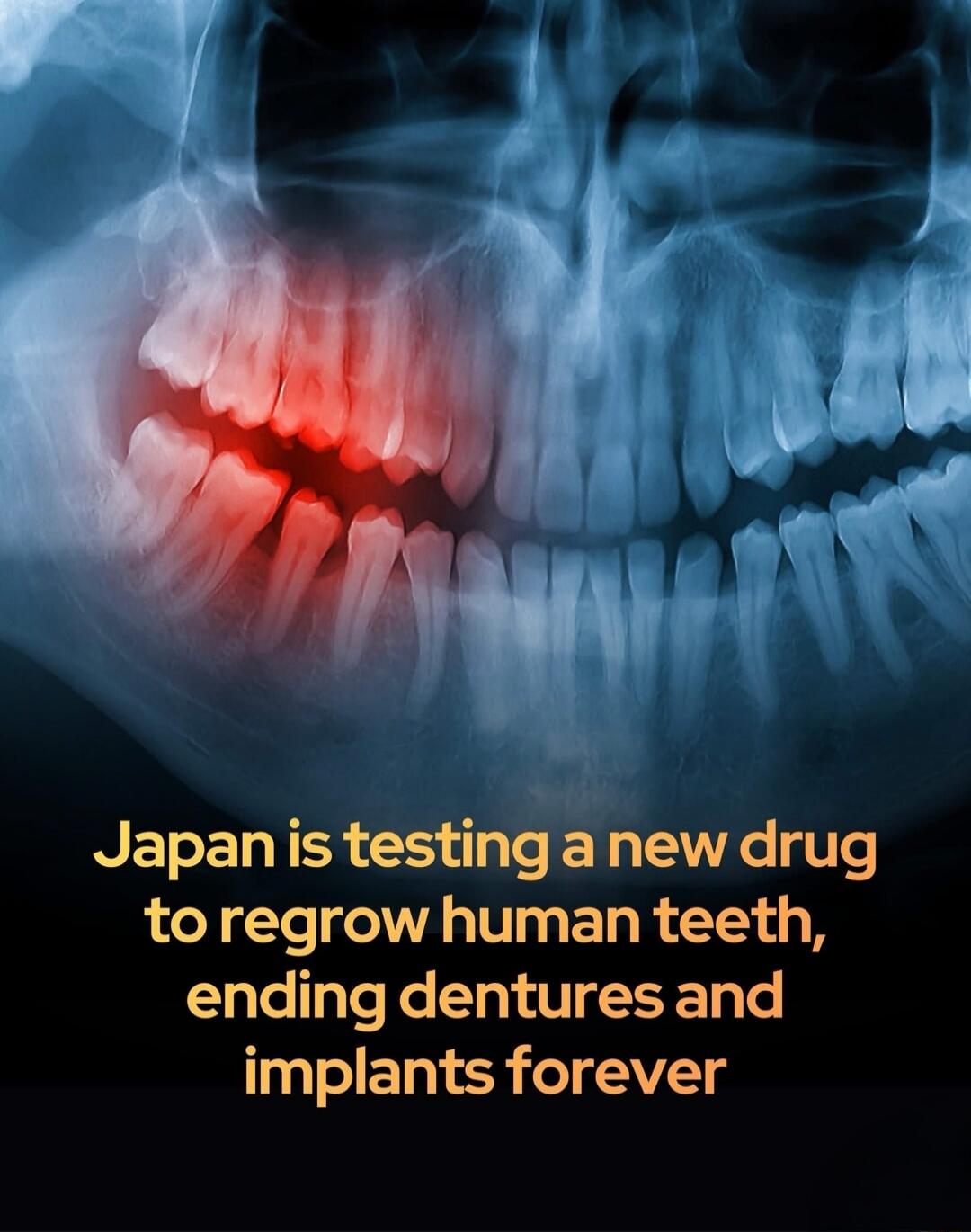 Japan is testing a new drug to regrow human teeth, ending dentures and implants forever
Session ID: 1048265.