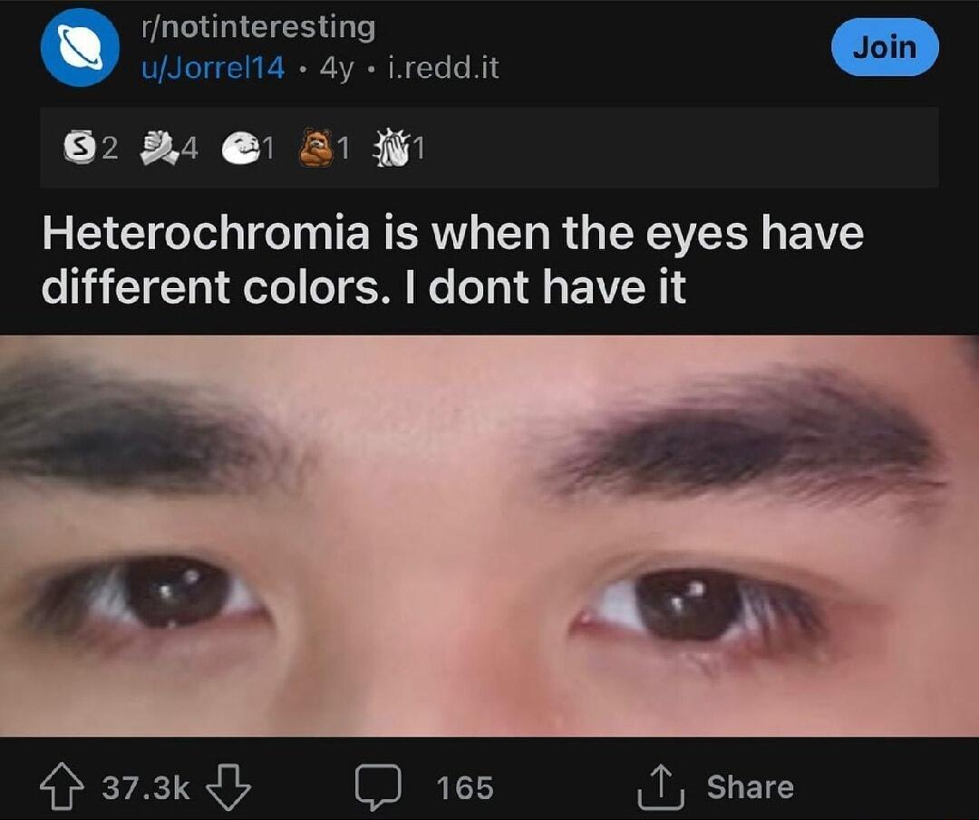 rotinteresting 4y ireddit 62 2 1 W L T T T TE R IR T R TSR AVER A different colors dont have it