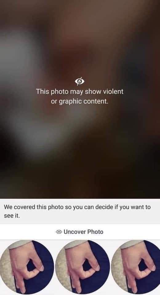 b This photo may show violent or graphic content We covered this photo so you can decide if you want to seeit Uncover Photo