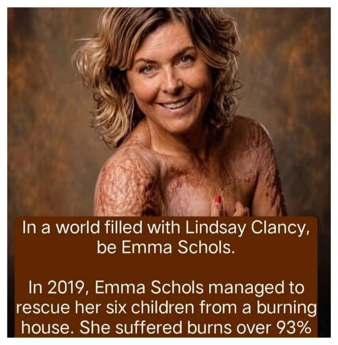 In a world filled with Lindsay Clancy, be Emma Schols. In 2019, Emma Schols managed to rescue her six children from a burning house. She suffered burns over 93%