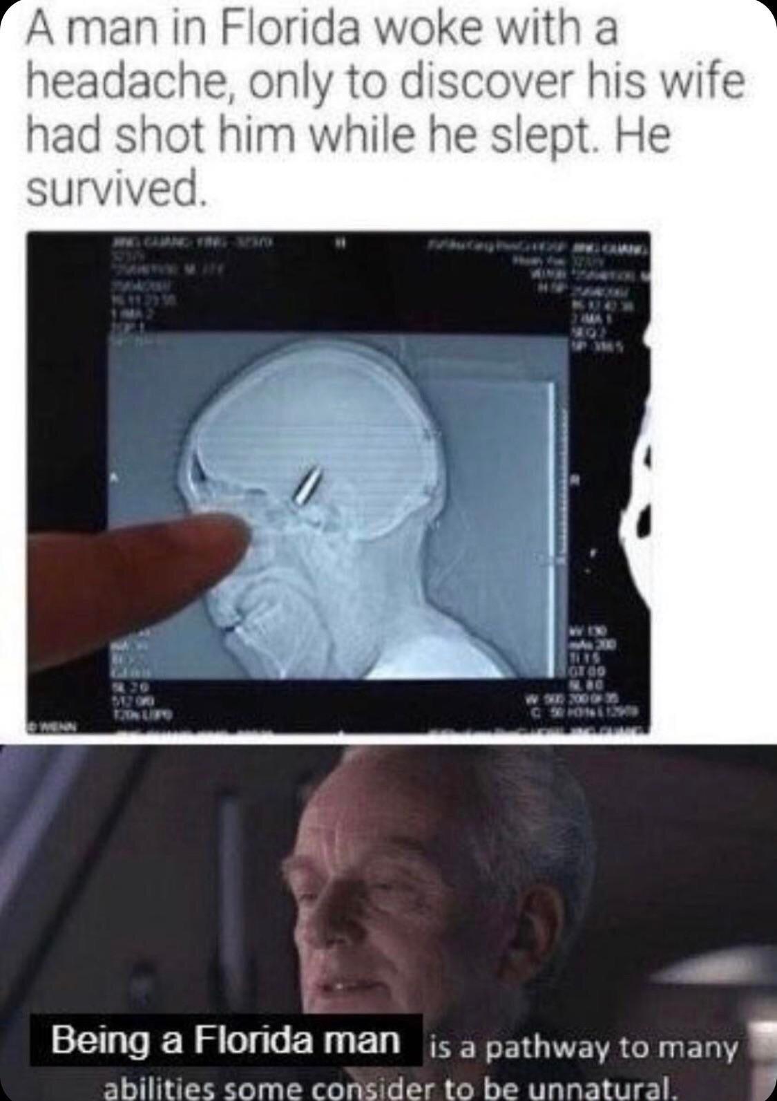 A man in Florida woke with a headache only to discover his wife had shot him while he slept He survived b Being a Florida man s a pathway to many abilities come consider to be unnatural 1