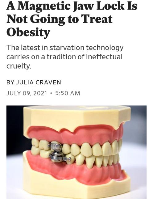 A Magnetic Jaw Lock Is Not Going to Treat Obesity The latest in starvation technology carries on a tradition of ineffectual cruelty BY JULIA CRAVEN JULY 092021 550 AM