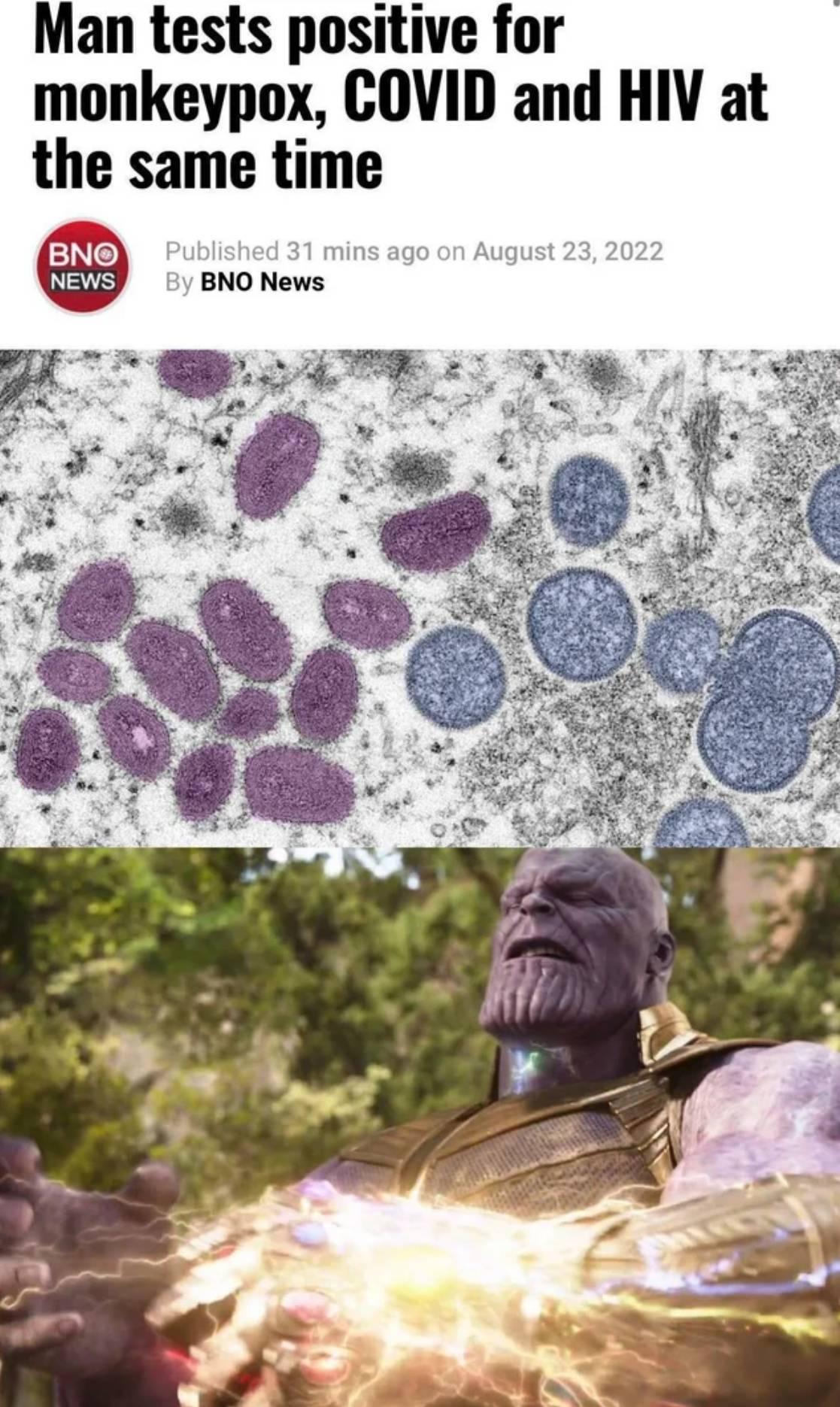 Man tests positive for monkeypox COVID and HIV at the same time BNO News