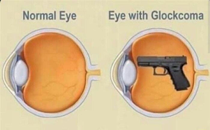 Normal Eye Eye with Glockcoma